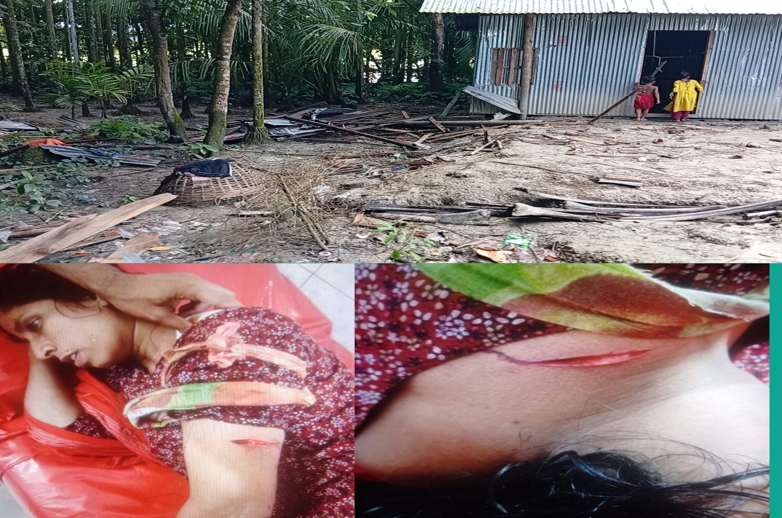 ভোলায় জমি নিয়ে বিরোধের জেরে হামলা, একই পরিবারের তিনজন আহত, থানায় মামলা