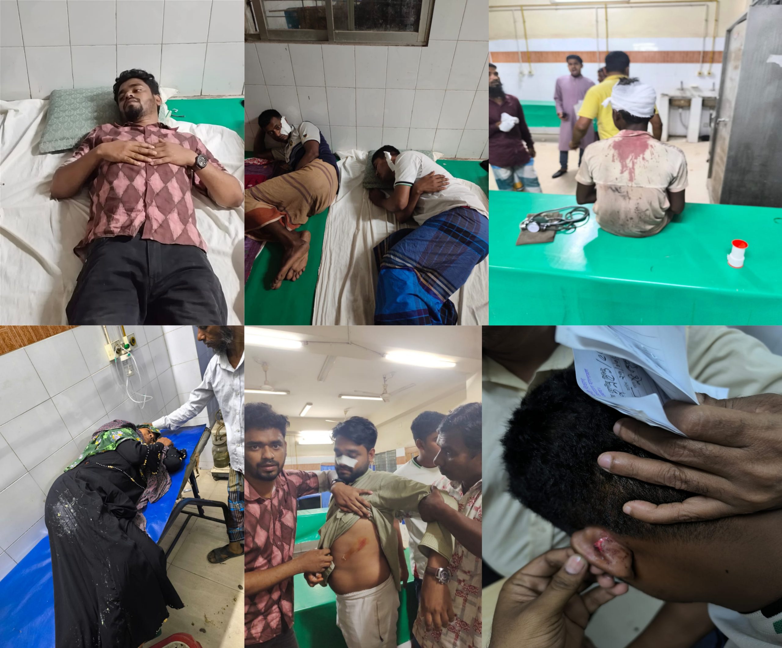 কাচিয়া ইউনিয়নে ইউপি সদস্য পদে প্রার্থী ঘোষণাকে কেন্দ্র করে হামলা, আহত  ১২