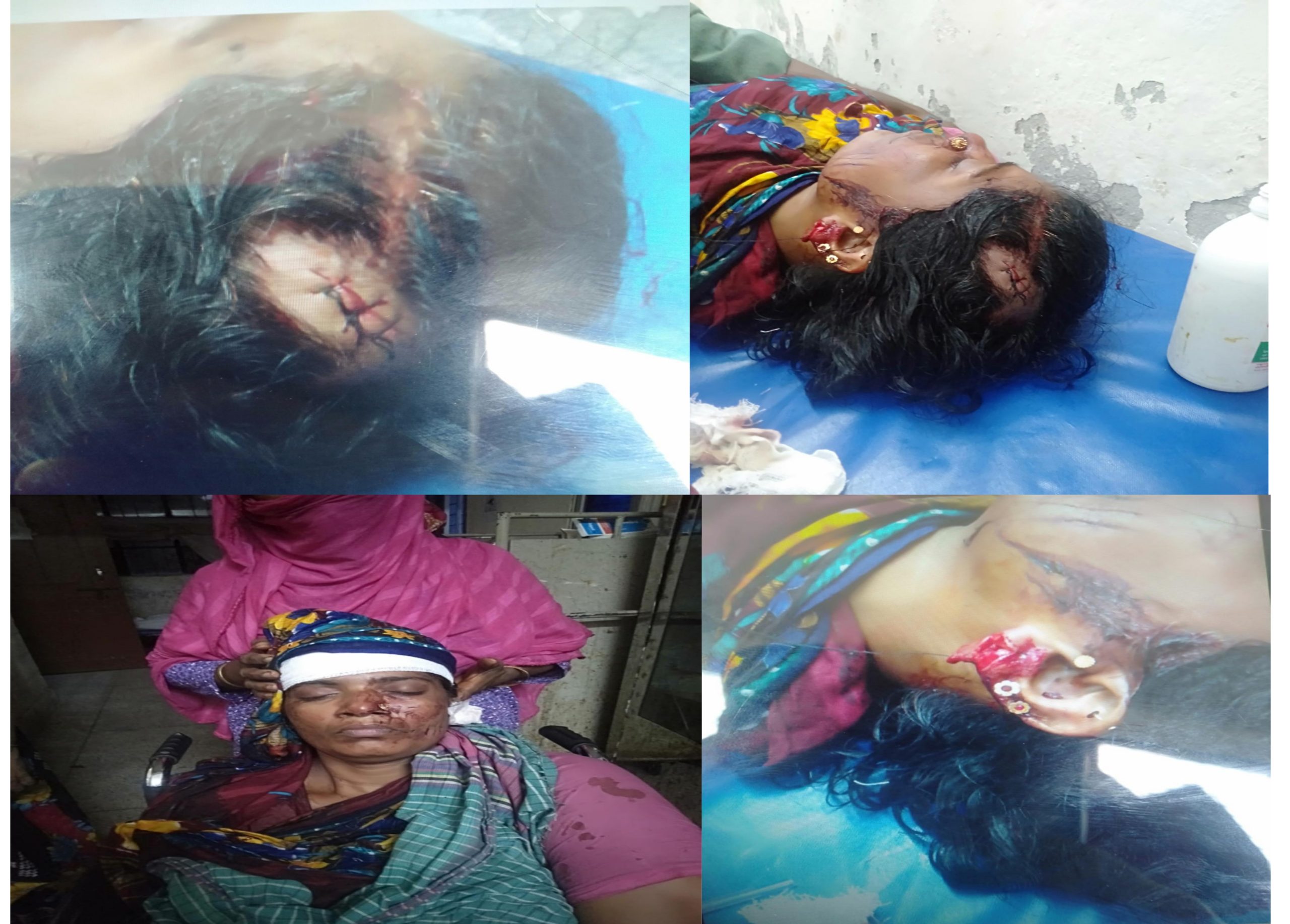 বোরহানউদ্দিনে রাতের আঁধারে লুটপাট: চিকিৎসার টাকা হারিয়ে বিপাকে পরিবার স্ত্রী-সন্তান রক্তাক্ত