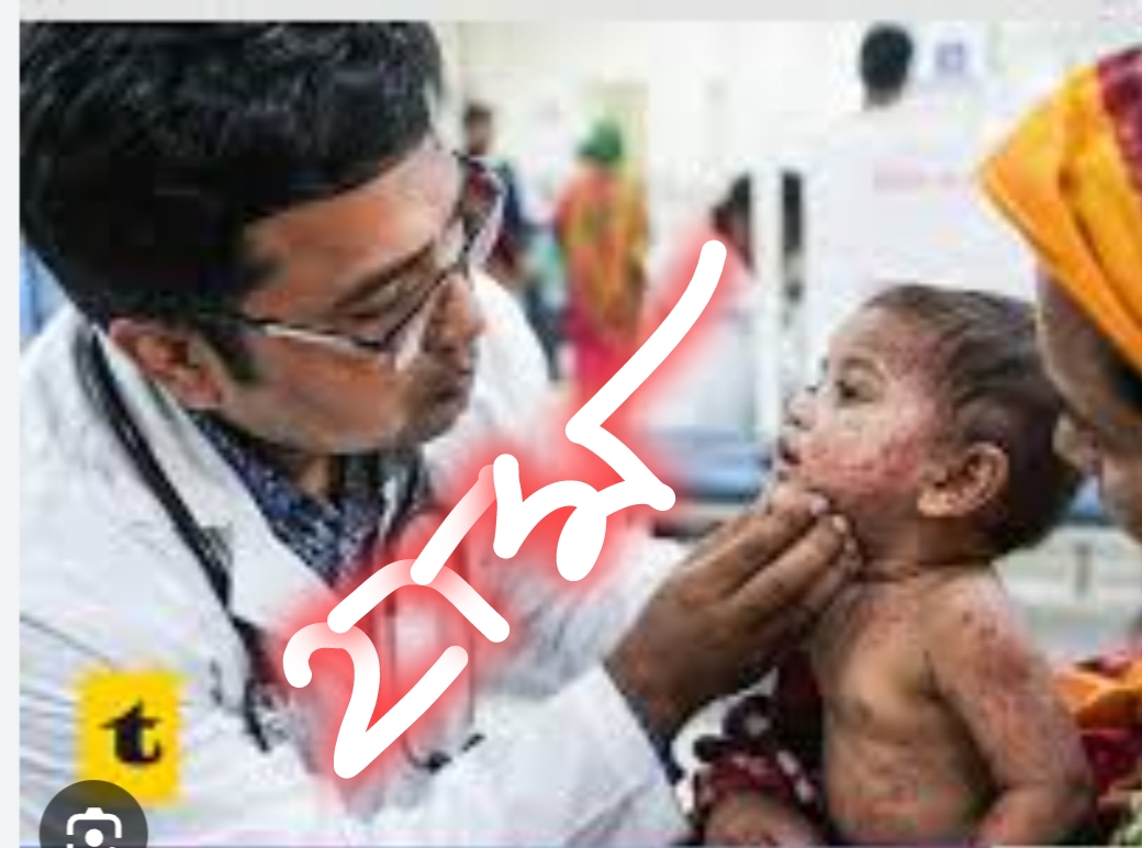 হামের প্রাদুর্ভাব ও আমাদের সামগ্রিক দায়