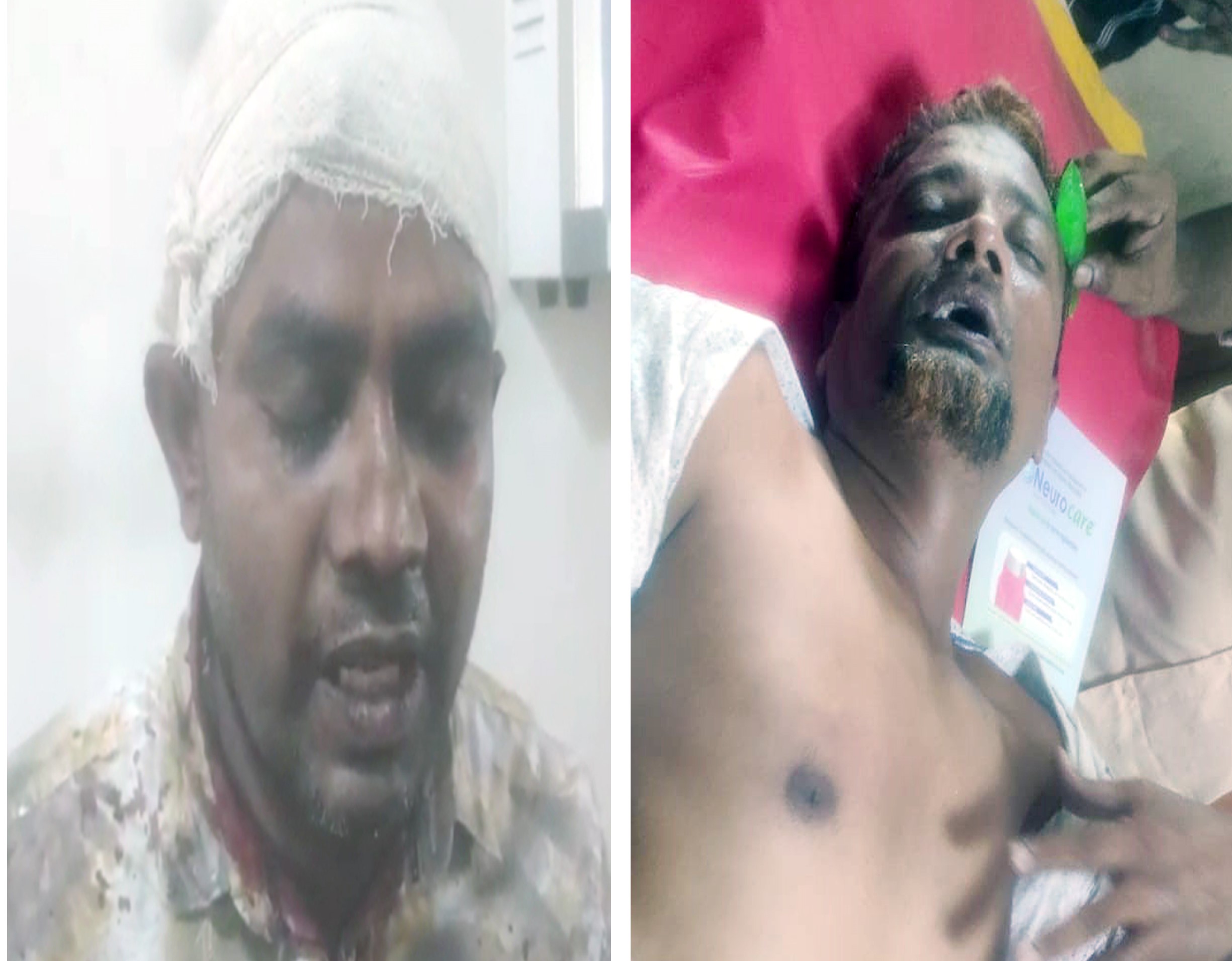 তজুমদ্দিনে সমুদ্রগামী জেলেদের চাল বিতরণের অনিয়মের  প্রতিবাদ করায় হামলা আহত-৫